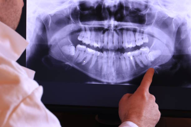 Best Emergency Treatment for Dental Infections or Abscesses in Marble Hill, MO