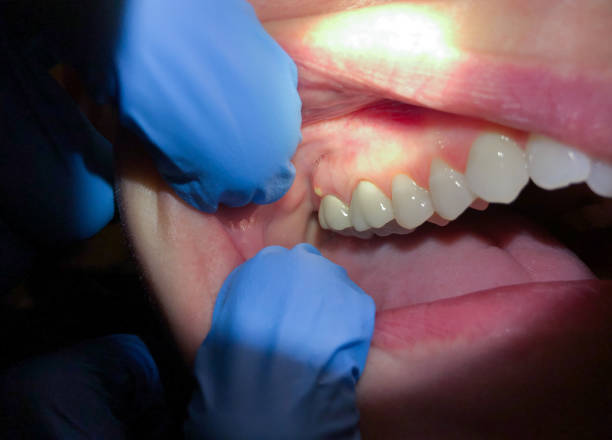 Best Cosmetic Emergency Dentistry in Marble Hill, MO